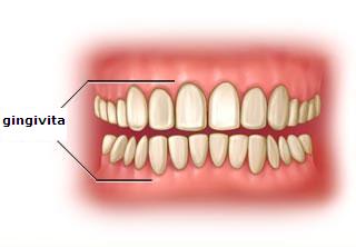 Gingiile: roz inseamna sanatos