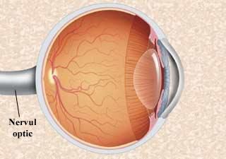 Glaucomul