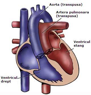 Transpunerea marilor artere